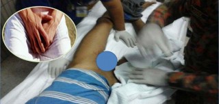 प्रेममा धोका दिएपछि प्रेमिकाले काटिदिइन् प्रेमीको लिङ्ग 