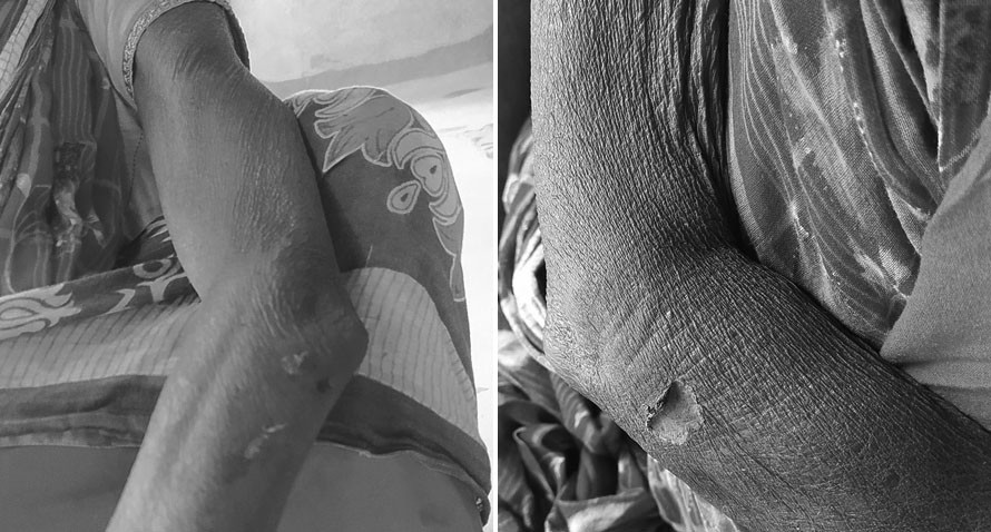 बोक्सी आरोपमा वृद्धामाथि निर्घात कुटपिट