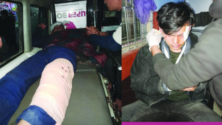 बागलुङकाे बडिगाडमा माेटरसाइकल दुर्घटना हुँदा दुई जना गम्भीर