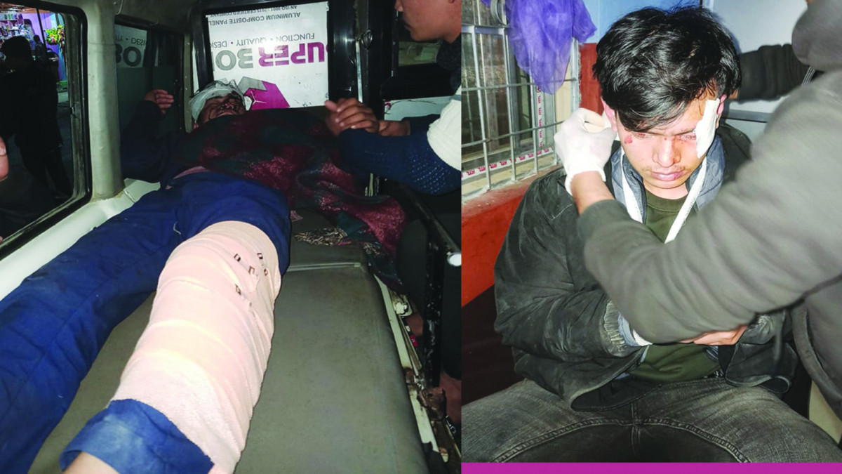 बागलुङकाे बडिगाडमा माेटरसाइकल दुर्घटना हुँदा दुई जना गम्भीर